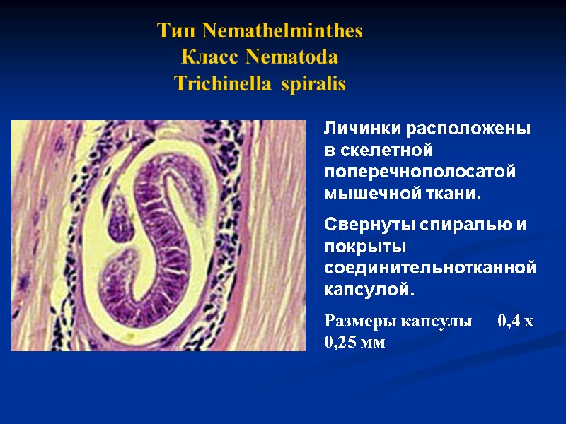 Тип Nemathelminthes Класс Nematoda Trichinella spiralis Личинки расположены в скелетной поперечнополосатой мышечной ткани. Свернуты